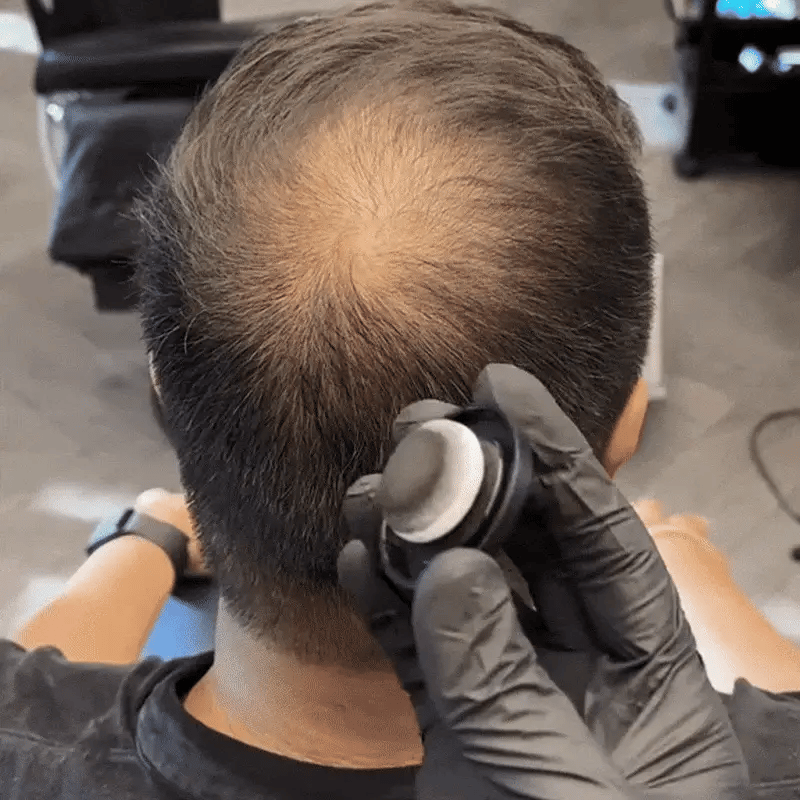 Hairline Powder - Instant Root Touch Up & Thinning Hair Concealer